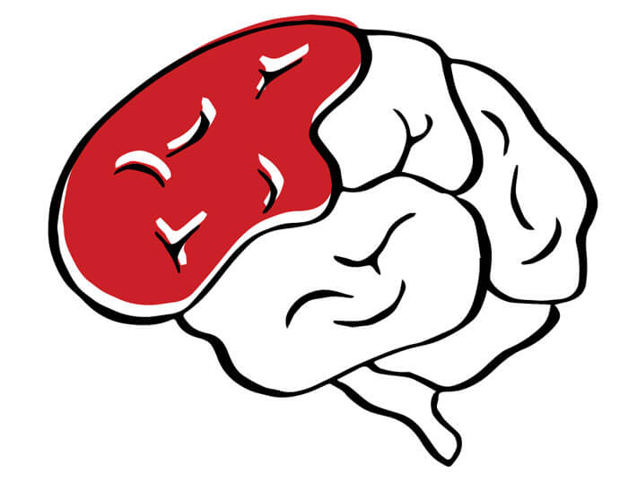 Black outline of a brain and with one lobe colored in red.